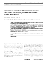 Spontaneous resolution of Descemet membrane detachment following big-bubble deep anterior lamellar keratoplasty