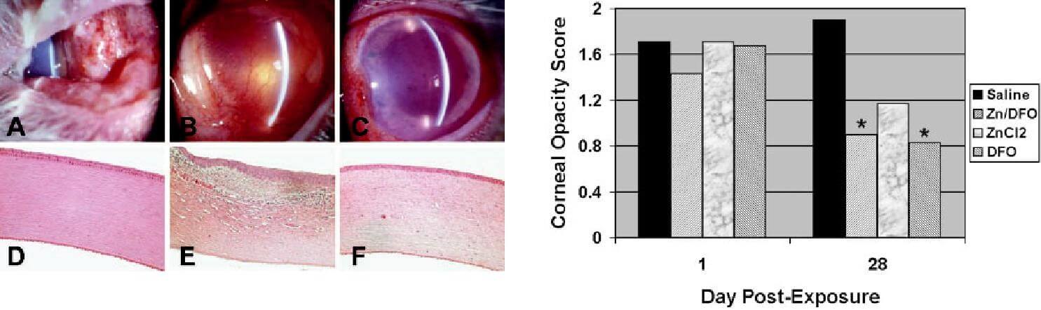 Conjunctivitis surgery