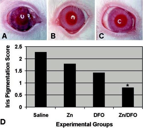 Conjunctivitis surgery